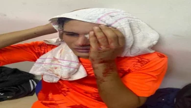 "إيقاف وتكفل بعلاج".. 4 قرارات عاجلة من الترسانة بشأن مشاجرة لقاء أبو قير الدموية