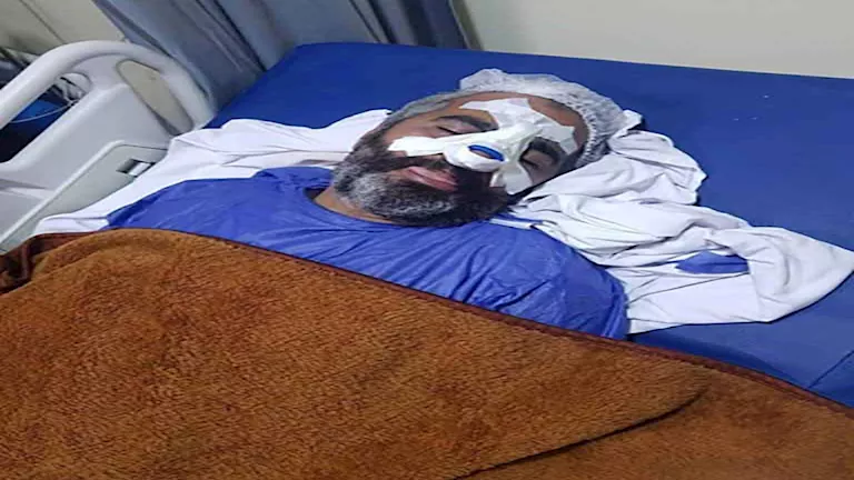 "مجزرة وشرخ في الضلع و8 غرز".. مدرب أبو قير يكشف لمصراوي كواليس اشتباكات الترسانة